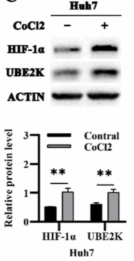 WB indicates the increased level of UBE2K protein in Huh7 under hypoxia.jpg